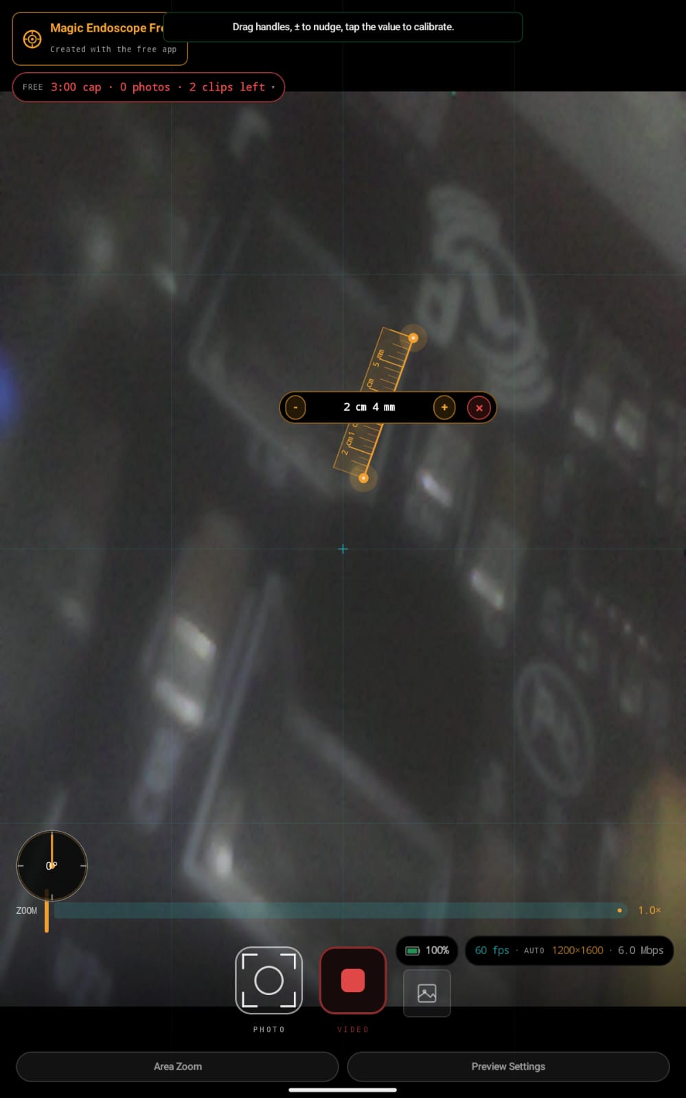 Magic Endoscope on-screen measurement ruler