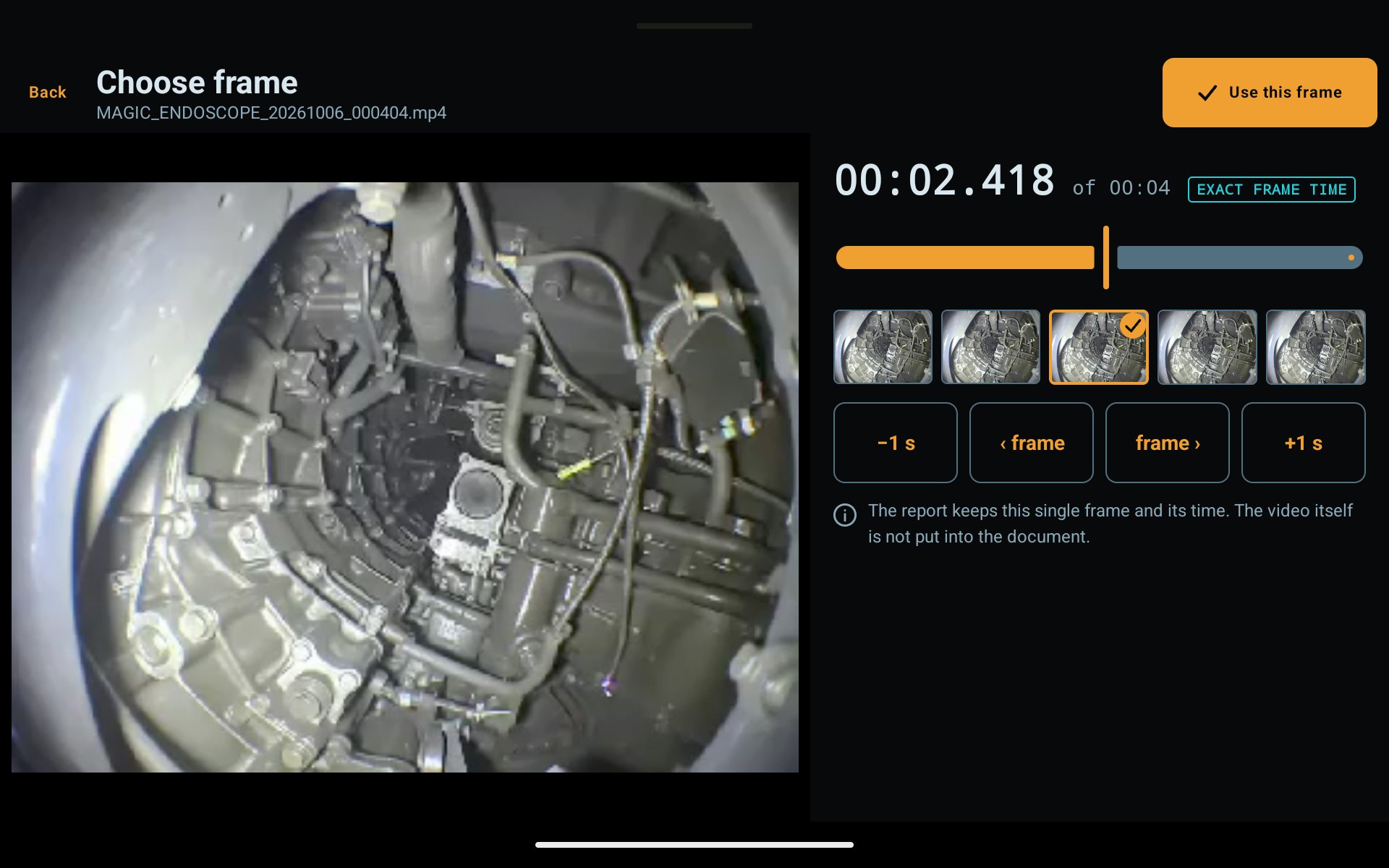 Magic Endoscope Choose frame on a tablet: a video frame with its exact time, a strip of frames and step buttons